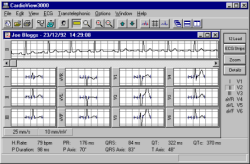 CardioView 3000
